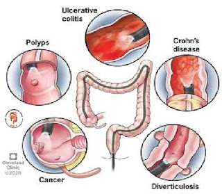 BD Endoscopy Center 